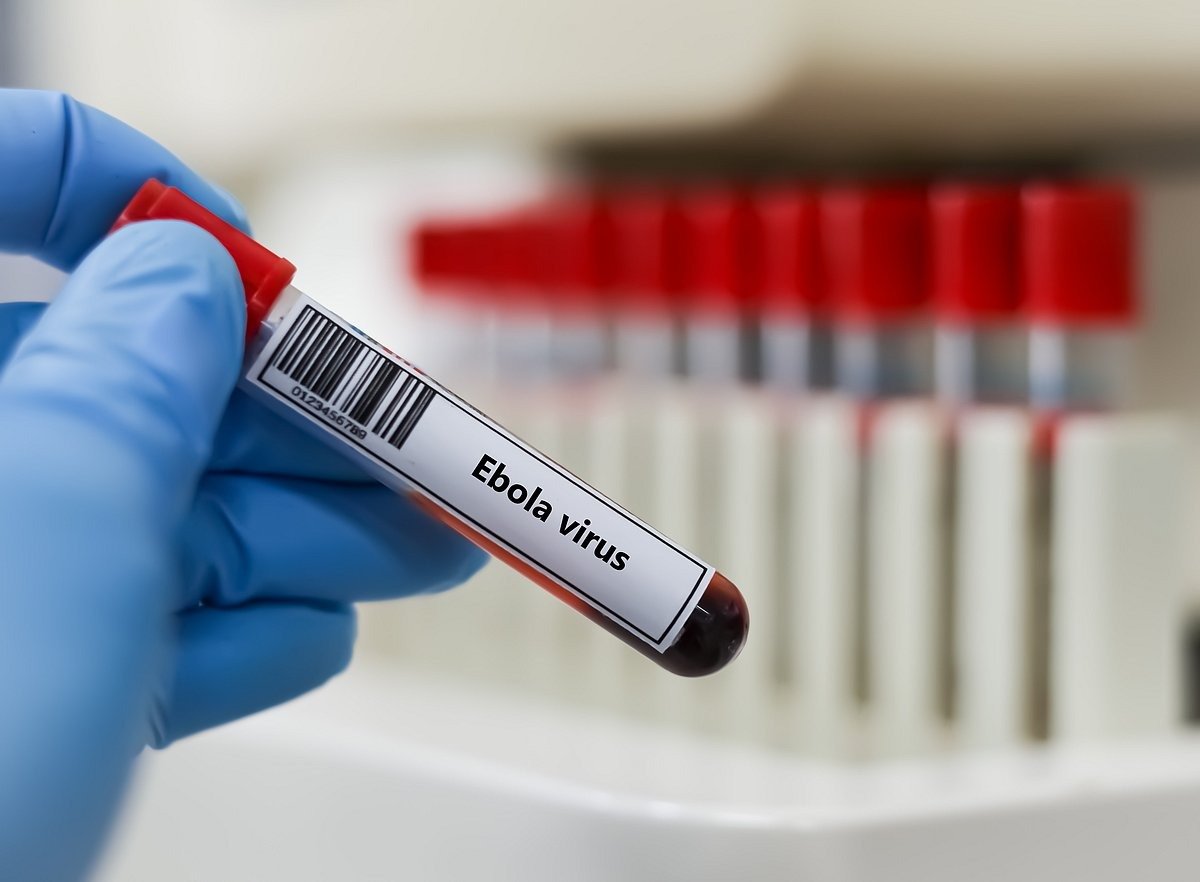 Ebola vaccine candidates